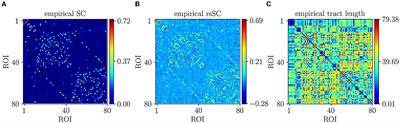 Enhanced simulations of whole-brain dynamics using hybrid resting-state structural connectomes